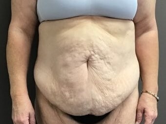 Before Image
