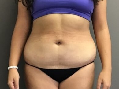Before Image