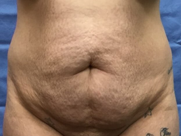 Before Image