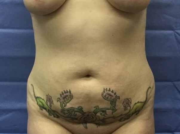 Before Image