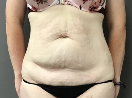 Before Image