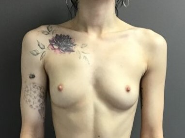 Before Image