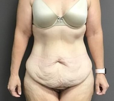 Before Image