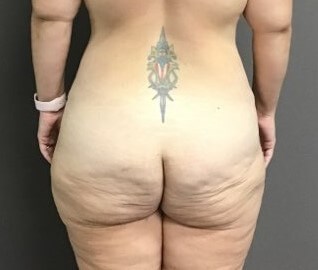 Posterior Before