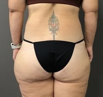 Posterior After