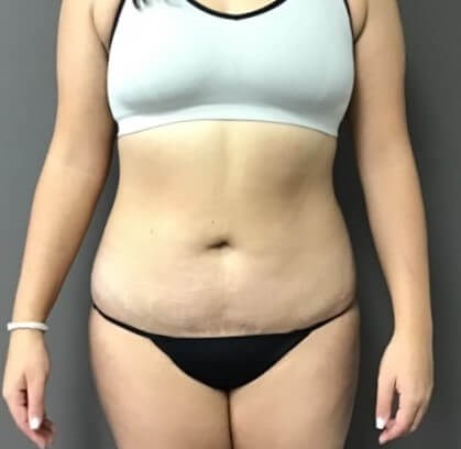 After Image