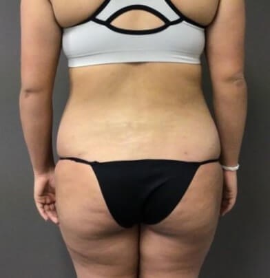 Posterior After