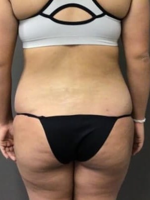 Posterior After
