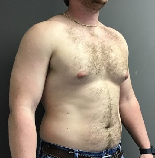 Oblique Before