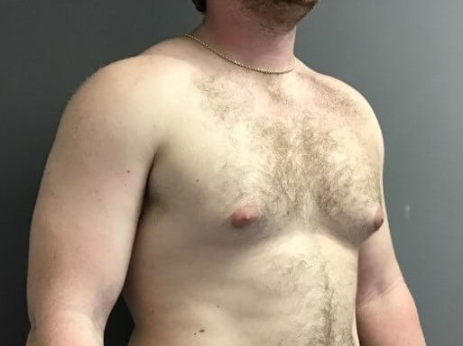 Oblique Before
