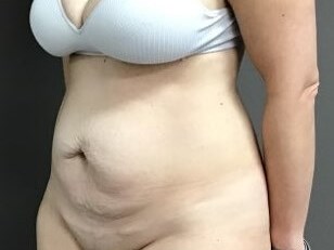 Oblique Before