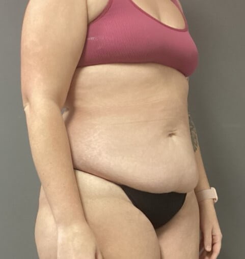 Oblique Before