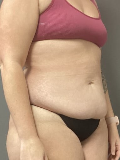 Oblique Before