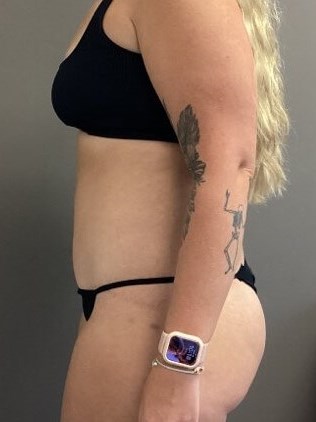 Side After