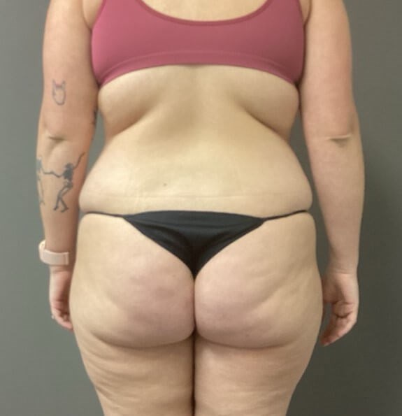 Posterior Before