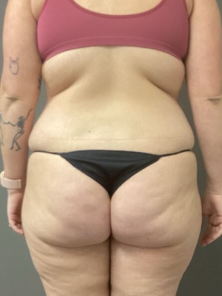 Posterior Before