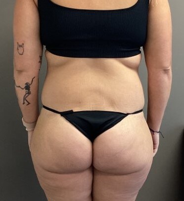 Posterior After