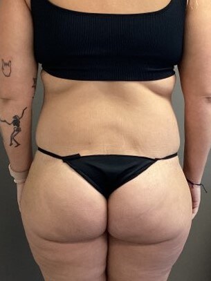Posterior After