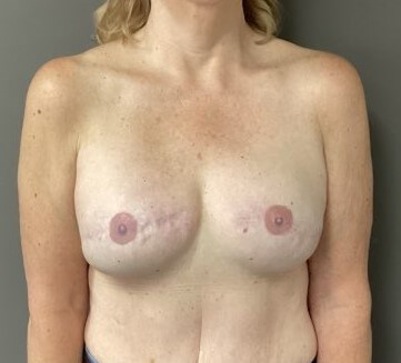 After Image