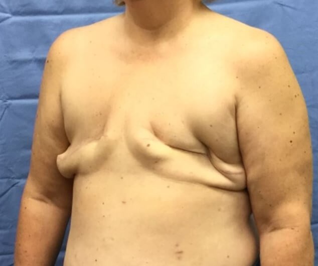 Oblique Before