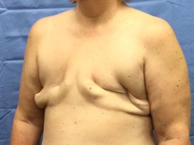 Oblique Before