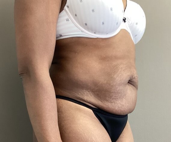 Oblique Before