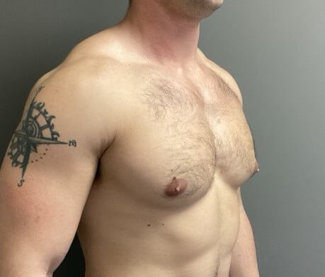 Oblique Before