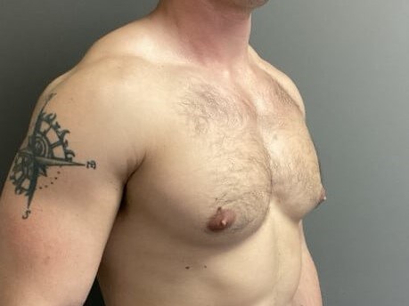 Oblique Before