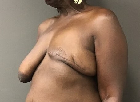Oblique Before
