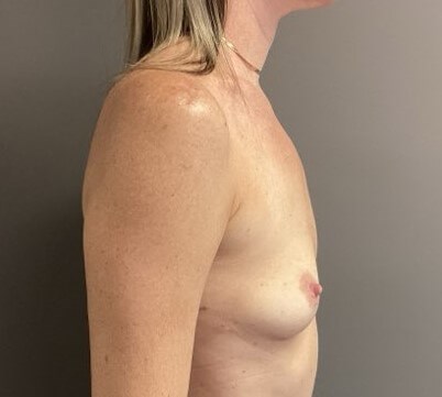 Side Before