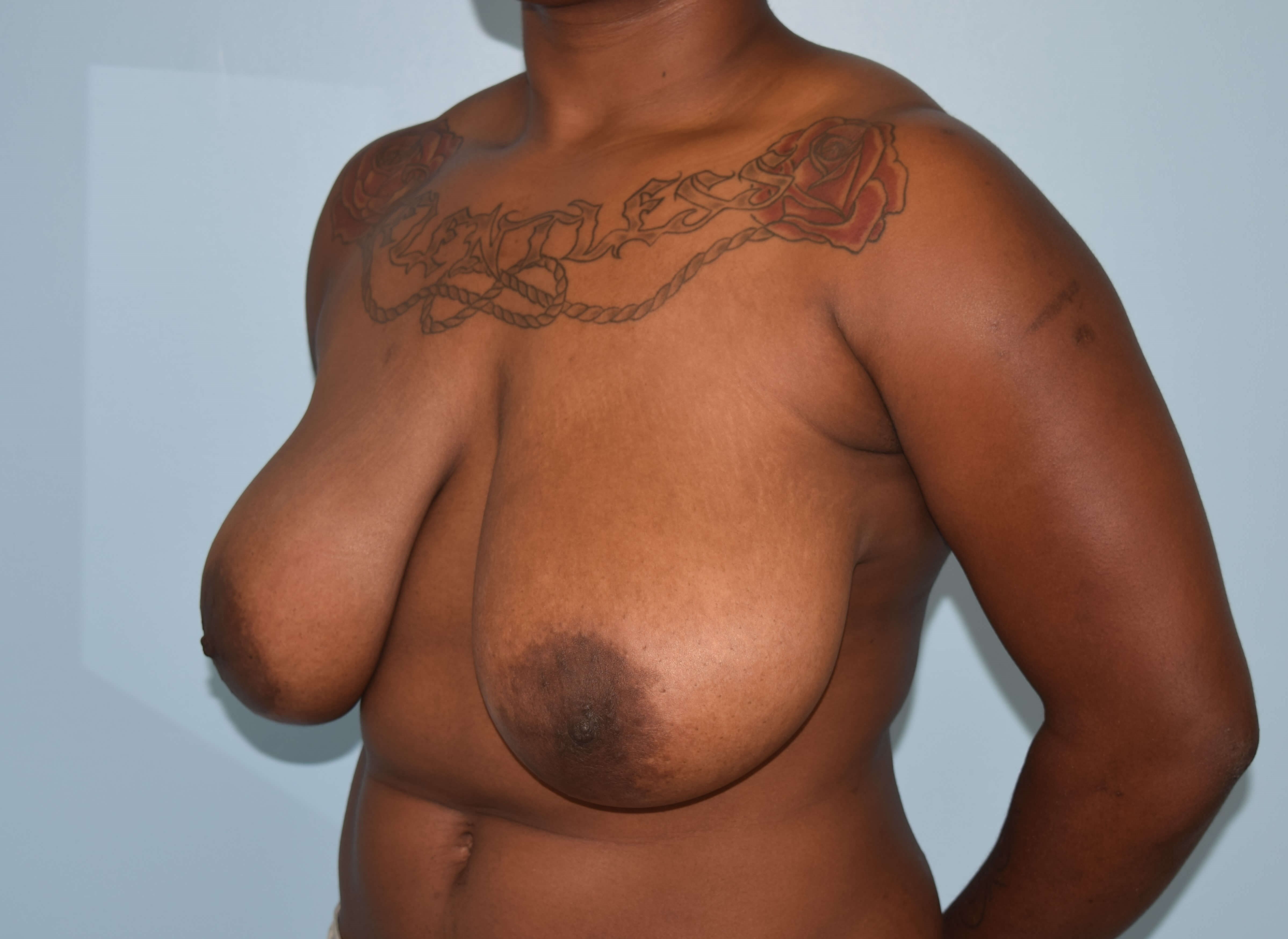 Oblique Before