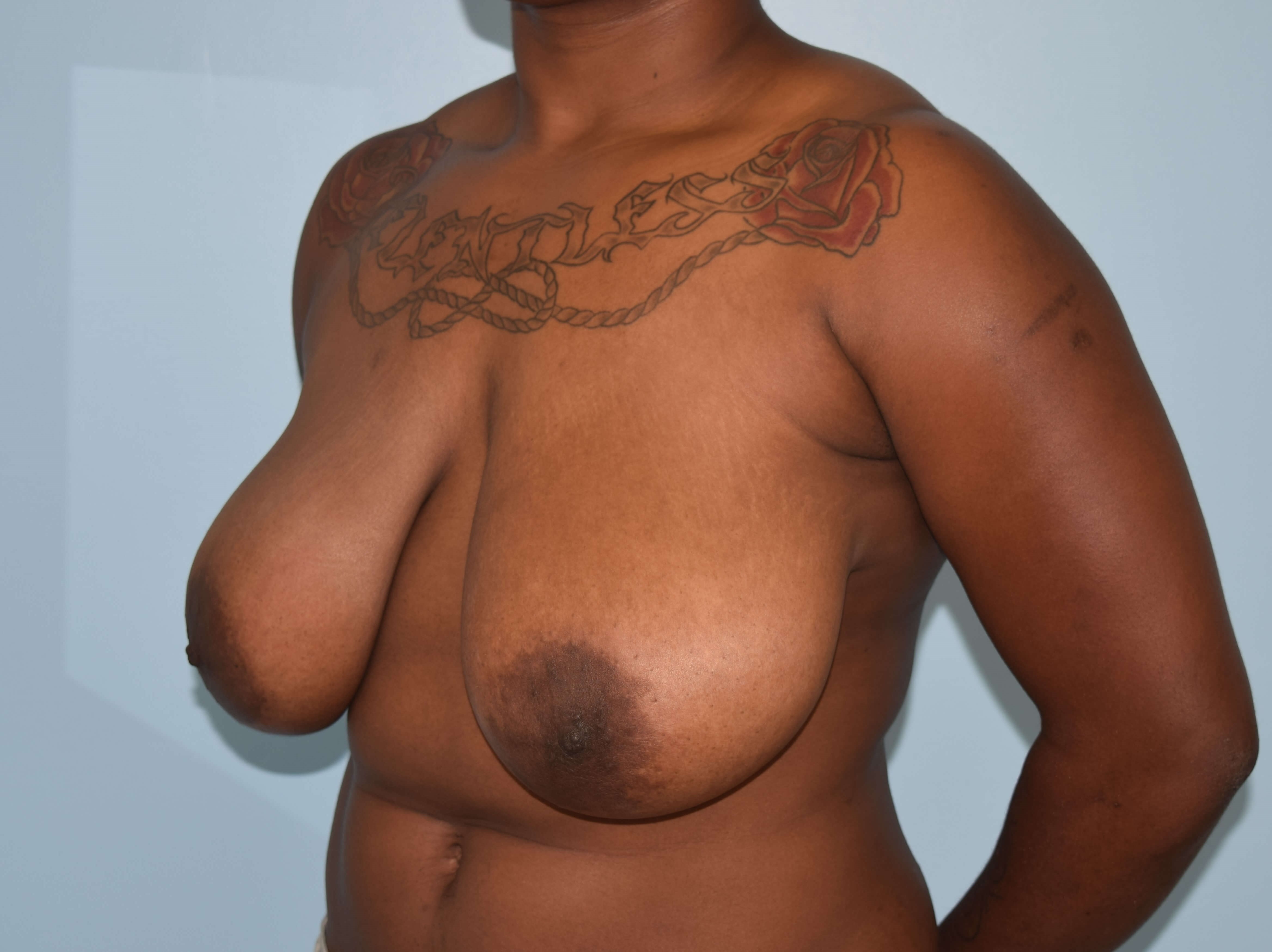 Oblique Before