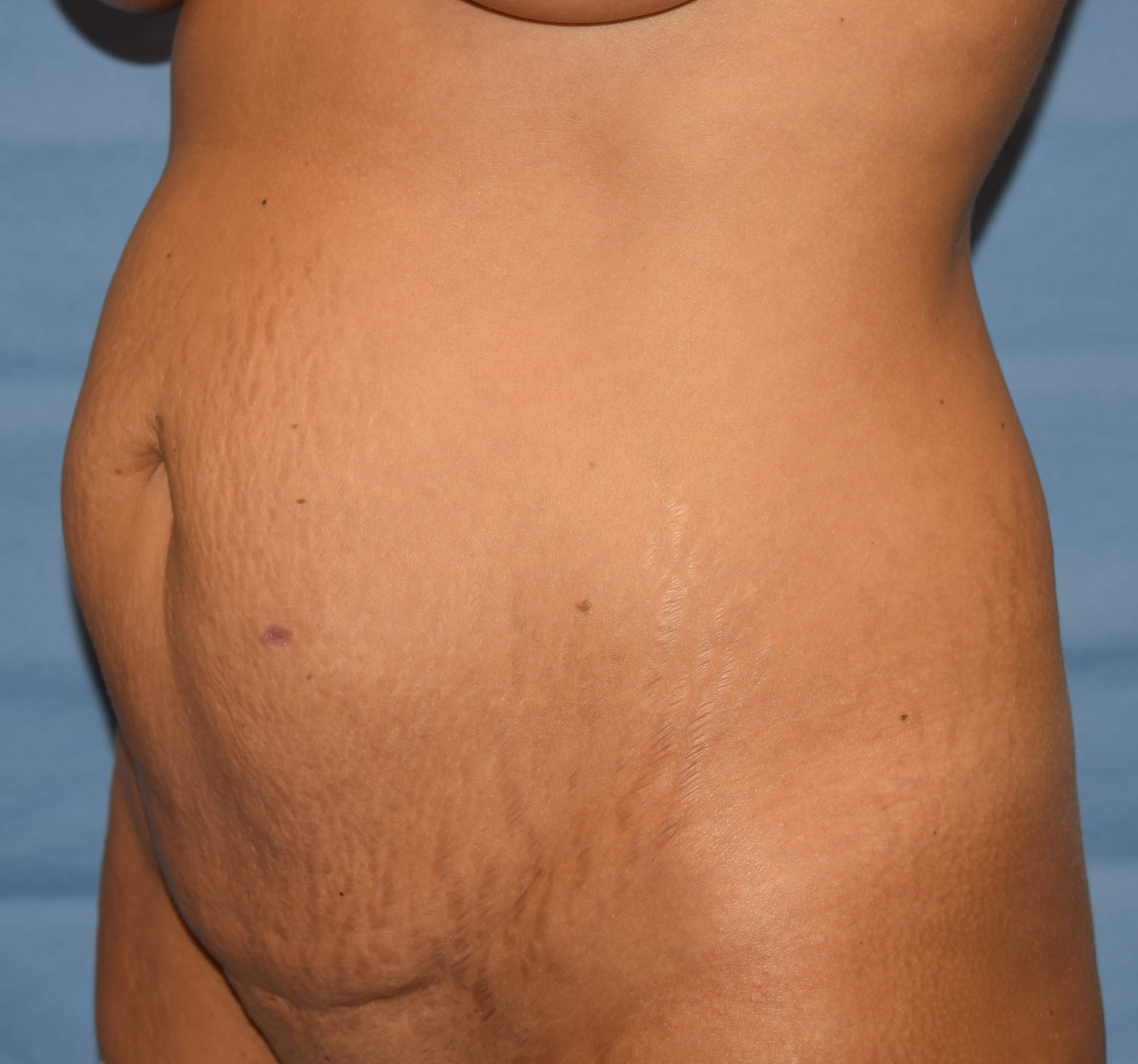 Oblique Before