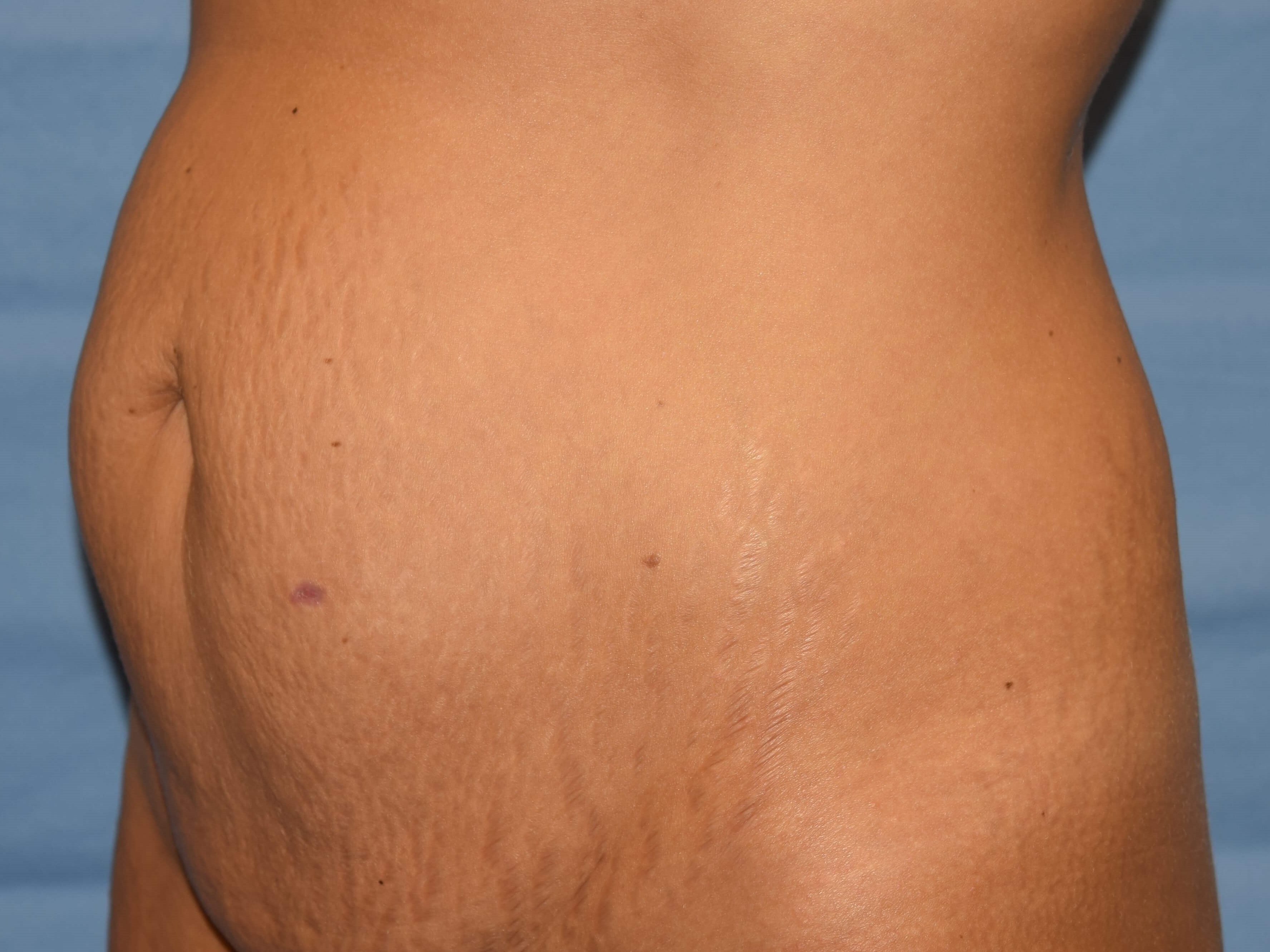 Oblique Before