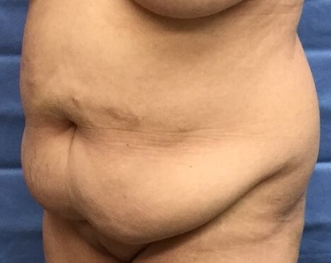 Oblique Before