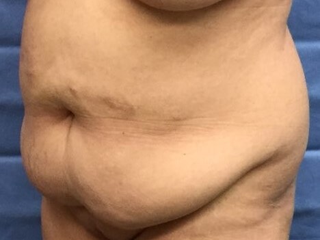 Oblique Before