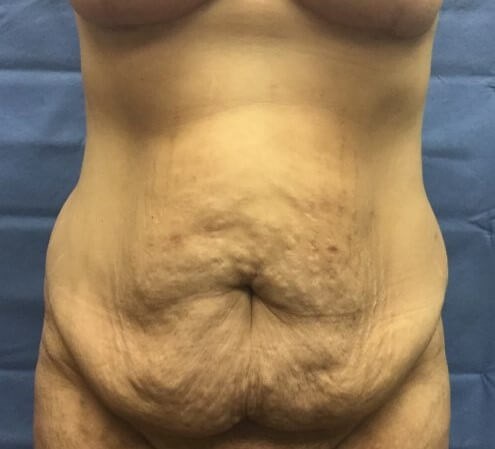 Before Image