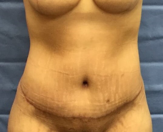 After Image