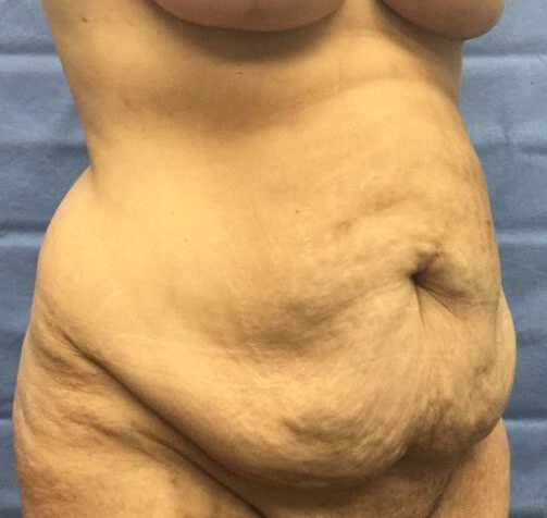 Oblique Before