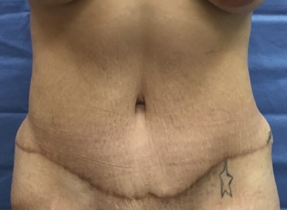 After Image