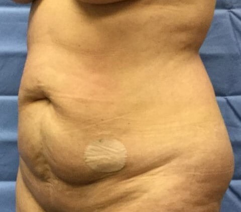 Oblique Before