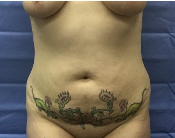 Before Image