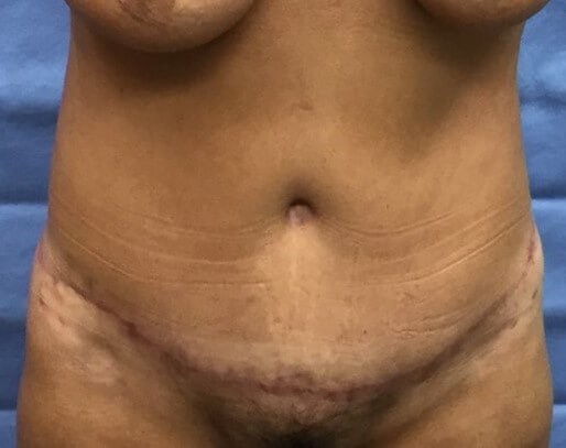 After Image