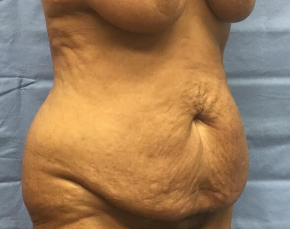 Oblique Before