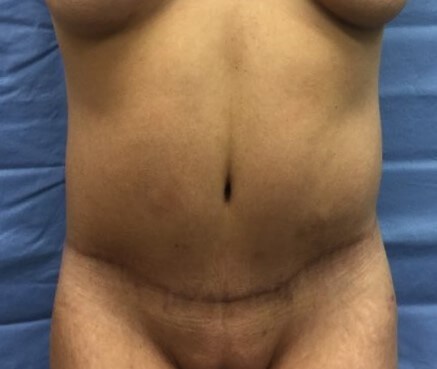 After Image