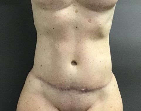 After Image