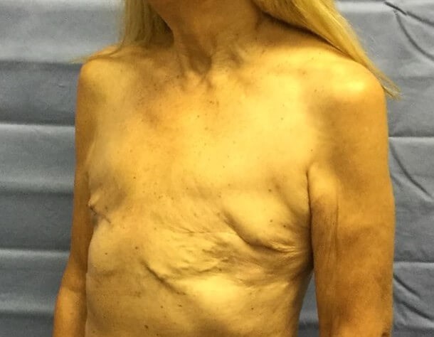 Oblique Before
