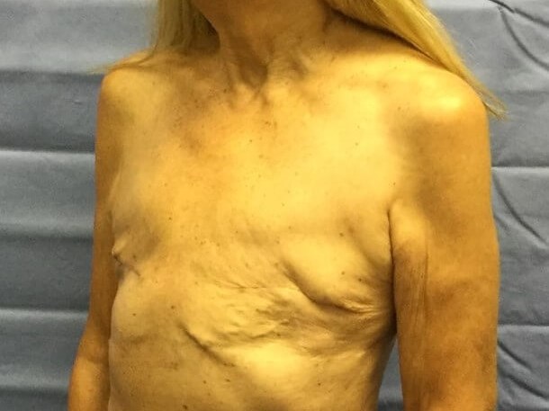 Oblique Before
