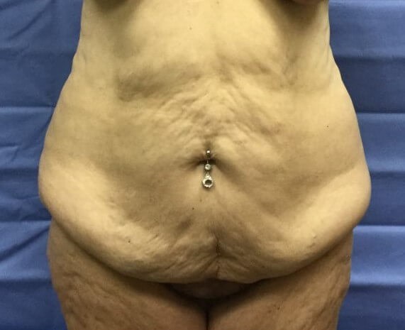 Before Image