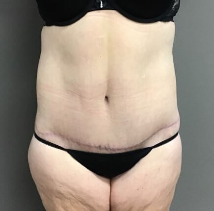 After Image